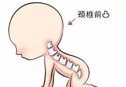 呵护成长之柱 不可忽视的宝宝脊柱健康