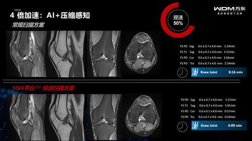 美的医疗AI荣登医疗健康先锋榜 以全链路重构脊柱健康精准诊疗工作流